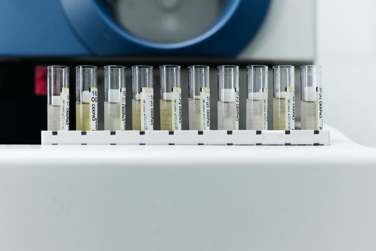 LB Semicon: 4 dicas para a transição de testes à produção gl